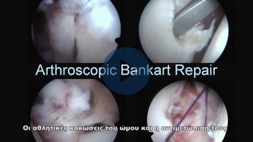 Embedded thumbnail for Οι αθλητικές κακώσεις του ώμου και η αντιμετώπιση τους