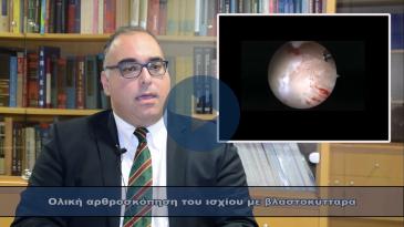 Embedded thumbnail for Ολική αρθροσκόπηση του ισχίου με βλαστοκύτταρα