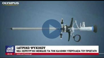 Embedded thumbnail for ΑΝΤ1 News, 7/2/18 – Νέα Χειρουργική Μέθοδος για την Υπερπλασία του Προστάτη