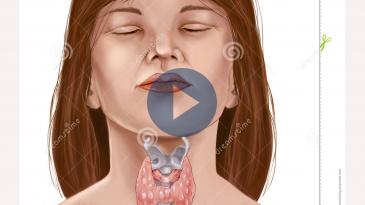 Embedded thumbnail for Για πρώτη φορά θυρεοειδεκτομή χωρίς ουλές στο Διαβαλκανικό