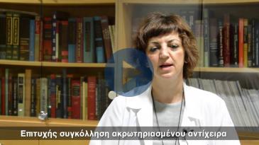 Embedded thumbnail for Επιτυχής συγκόλληση ακρωτηριασμένου αντίχειρα