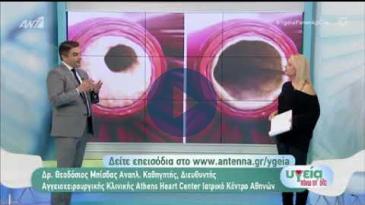 Embedded thumbnail for Υγεία Πάνω απ’ όλα - 23/11/2019, Θεόδωρος Μπίσδας - Διαβητικό Πόδι