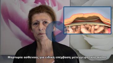 Embedded thumbnail for Μαρτυρία ασθενούς με μετεγχειρητική κήλη