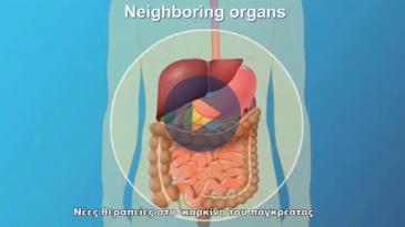 Embedded thumbnail for Χατζηθεόκλητος - Εμμανουηλίδης: Σημαντικές εξελίξεις για τον καρκίνο παγκρέατος, στην ημερίδα