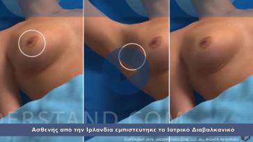 Embedded thumbnail for Μαρτυρία Ιρλανδής ασθενούς για επεμβάσεις πλαστικής χειρουργικής