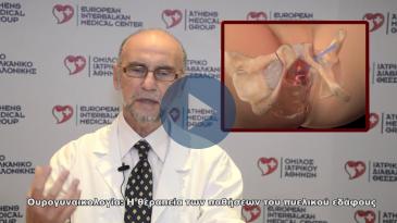 Embedded thumbnail for Ουρογυναικολογία: Θεραπεία των παθήσεων του πυελικού εδάφους