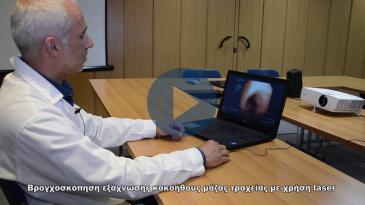 Embedded thumbnail for Βρογχοσκόπηση εξάχνωσης κακοήθους μάζας τραχείας με χρήση λέιζερ