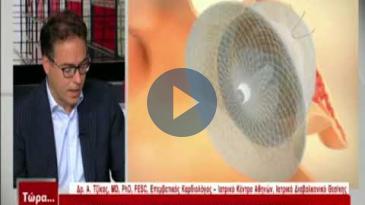 Embedded thumbnail for Τώρα.. ό,τι συμβαίνει - 19/05/2018, Α. Τζίκας - Νέες τεχνικές για την πρόληψη εγκεφαλικών επεισοδίων