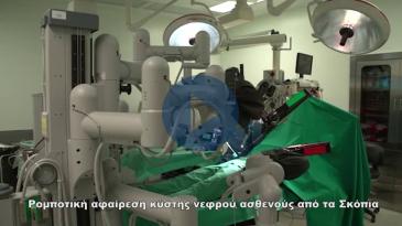 Embedded thumbnail for Ρομποτική αφαίρεση κύστης νεφρού ασθενούς από τα Σκόπια