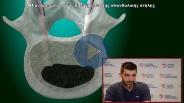 Embedded thumbnail for Η αντιμετώπιση των καταγμάτων της σπονδυλικής στήλης