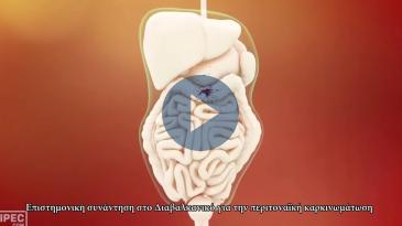 Embedded thumbnail for Επιστημονική συνάντηση της Ευρωπαϊκής Σχολής Περιτοναϊκής Κακοήθειας στο Διαβαλκανικό