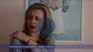 Embedded thumbnail for Διαδερμική αναρρόφηση επασβεστώσεων ώμου - Μαρτυρία ασθενούς