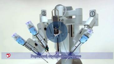 Embedded thumbnail for Ρομποτική αφαίρεση οισοφάγου - μαρτυρία ασθενούς