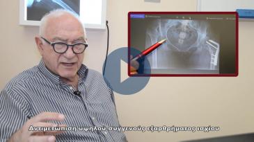 Embedded thumbnail for Ιδιαίτερο περιστατικό αντιμετώπισης συγγενούς εξάρθρωσης ισχύου