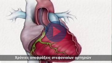 Embedded thumbnail for Χρόνιες αποφράξεις στεφανιαίων αρτηριών