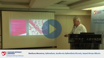 Embedded thumbnail for Οστεοαρθρίτιδα - Ολική αρθροπλαστική ισχίου με μέθοδο ASI - Μονοδιαμερισματική χειρουργική γόνατος