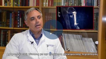 Embedded thumbnail for Αρθροπλαστική γόνατος με την πλοήγηση ηλεκτρονικής τεχνολογίας