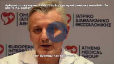 Embedded thumbnail for Αρθροπλαστική ισχίων AMIS σε ασθενή με αγκυλοποιητική σπονδυλίτιδα από το Καζαχστάν