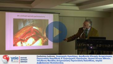 Embedded thumbnail for Ενδοπεριτοναϊκή Υπέρθερμη Χημειοθεραπεία (HIPEC) στο γυναικολογικό καρκίνο.