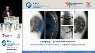 Embedded thumbnail for Σωτήρης Παπαστεφάνου - Ενίσχυση ΣΣ με ακρυλικό τσιμέντο: νέες λύσεις σε δύσκολα παλιά προβλήματα