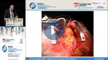 Embedded thumbnail for Βασίλειος Κωτσής - State of the Art xειρουργική των στεφανιαίων αγγείων με πάλλουσα καρδιά