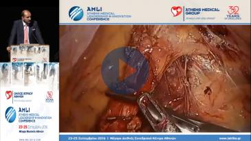 Embedded thumbnail for Χάρης Κωνσταντινίδης - Ρομποτική χαμηλή πρόσθια εκτομή