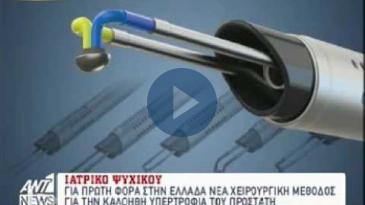 Embedded thumbnail for ΑΝΤ1 News - 30/10/16, Κυριάκος Μπρέμπος - Τεχνολογία PLASMA για την καλοήθη υπερτροφία του προστάτη