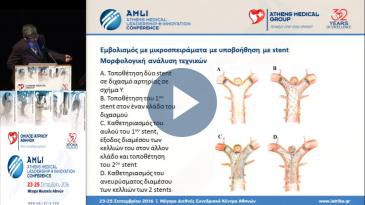 Embedded thumbnail for Βασίλης Κατσαρίδης - Eμβολισμοί ανευρυσμάτων εγκεφάλου: τελευταίες εξελίξεις