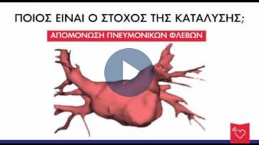 Embedded thumbnail for Δημήτρης Τσιαχρής - Κατάλυση Κολπικής Μαρμαρυγής