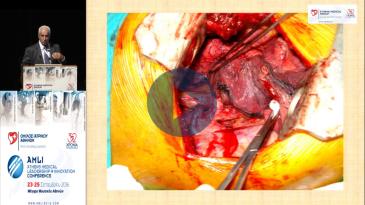 Embedded thumbnail for Τζαμπραήλ Νταχάμπρε - Σύγχρονη χειρουργική αντιμετώπιση του καρκίνου του πνεύμονα