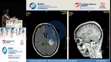 Embedded thumbnail for Δέσποινα Μισαηλίδου - Νεότερα δεδομένα στην IMRT