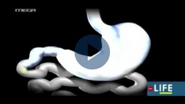 Embedded thumbnail for My Life - 11/06/16, Κωνσταντίνος Κωνσταντινίδης - Ρομποτικές επεμβάσεις κατά της παχυσαρκίας