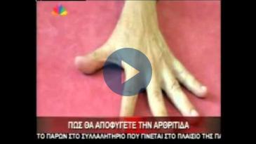 Embedded thumbnail for ΙΑΤΡΙΚΟ ΚΕΝΤΡΟ: Π. ΓΙΑΝΝΑΚΟΠΟΥΛΟΣ, Αρθρίτιδα