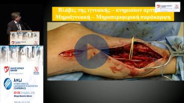 Embedded thumbnail for Αναστάσιος Παπαπέτρου - Περιφερική ισχαιμία - State of the art
