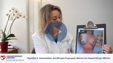 Embedded thumbnail for Κορνήλια Αναστασάκου - Ογκοπλαστική Χειρουργική Μαστού