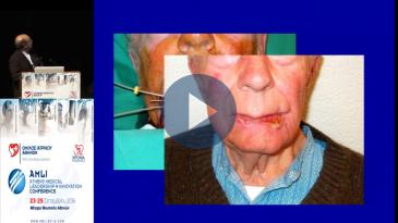 Embedded thumbnail for Ν.Ζαμπόγλου-Ενδοϊστική βραχυθεραπεία με 3D σχεδιασμό-Καθοδήγηση υπερηχογράφου ή αξονικού τομογράφου