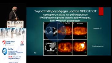 Embedded thumbnail for Δημήτριος Μαϊντάς - SPECT, PET fusion με CT ή MRI. Συσχέτιση δομής και λειτουργίας
