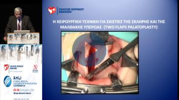 Embedded thumbnail for Εμμανουήλ Κουδουμνάκης - Η αντιμετώπιση των σχιστιών της υπερώας