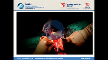 Embedded thumbnail for Πρόδρομος Παπαϊωάννου - Επεμβάσεις επαναπροσδιορισμού φύλου: μία σύγχρονη πρόκληση