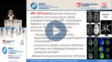 Embedded thumbnail for Κλημεντίνη Καραγεωργίου - Αντιμετώπιση αγγειακού εγκεφαλικού επεισοδίου - State of the Art