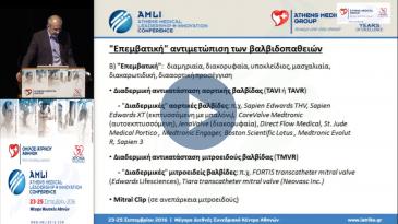 Embedded thumbnail for Μιχάλης Κανταρτζής - Σύγχρονες τεχνικές αντιμετώπισης των βαλβιδοπαθειών