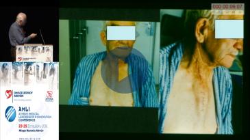 Embedded thumbnail for Παναγιώτης Γιαννόπουλος - Οισοφαγεκτομή χωρίς θωρακοτομή