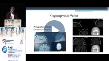 Embedded thumbnail for Ευρυπίδης Αντωνίου - Σύγχρονη αντιμετώπιση των κακοήθων όγκων εγκεφάλου