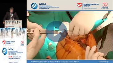 Embedded thumbnail for Ευάγγελος Γάκης - Εξατομικευμένη αρθροπλαστική MIS γόνατος