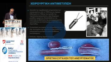 Embedded thumbnail for Χρύσανθος Αμπέρτος - Χειρουργική αντιμετώπιση των ανευρυσμάτων του κεντρικού νευρικού συστήματος