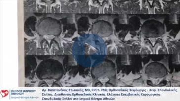 Embedded thumbnail for Στυλιανός Καπετανάκης – Κήλη Μεσοσπονδύλιου Δίσκου