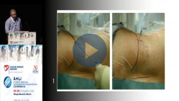 Embedded thumbnail for Στ. Καπετανάκης - Μέθοδος TESSYS για την αντιμετώπιση της οσφυικής δισκοκήλης